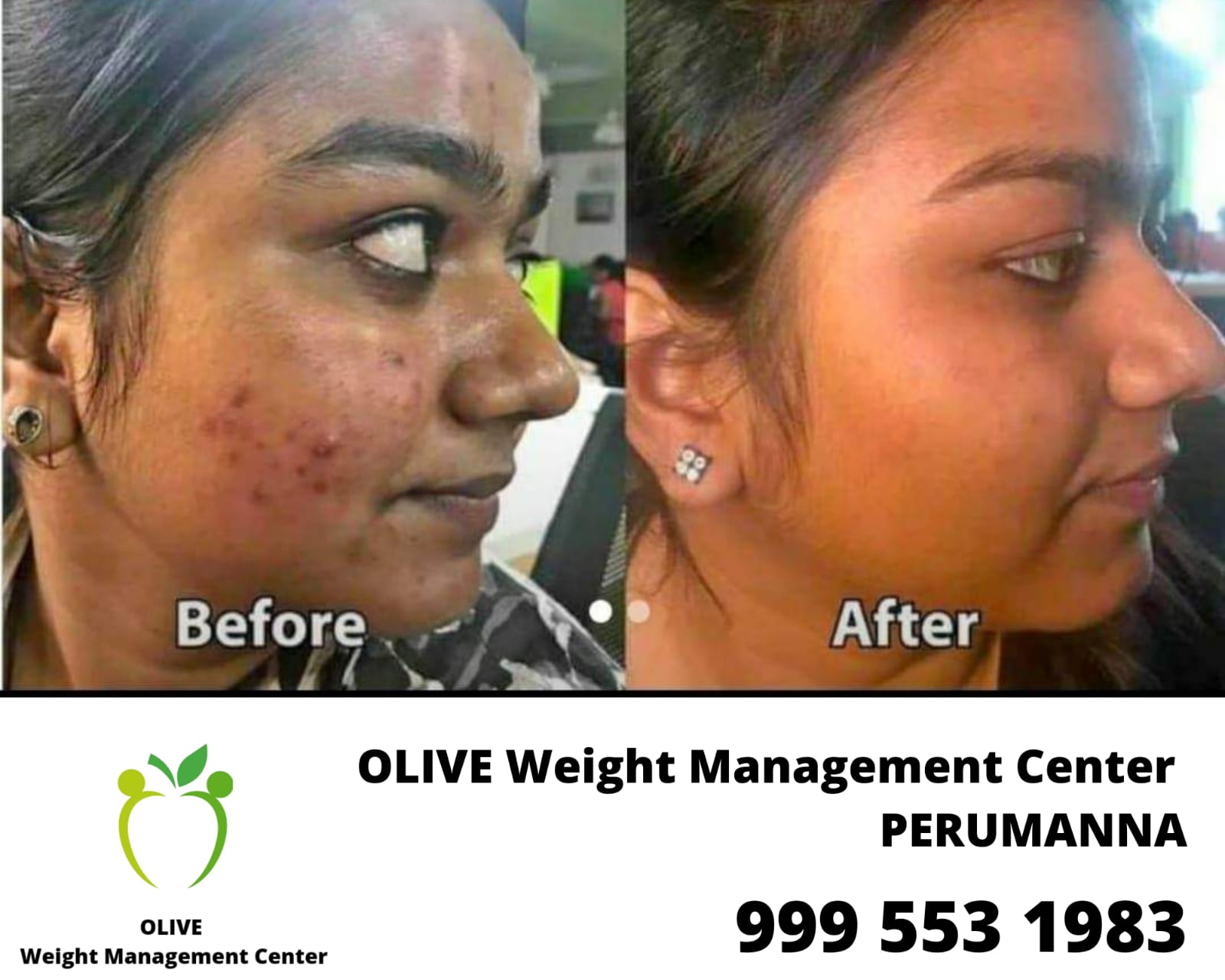 OLIVE Weight Management Center PERUMANNA