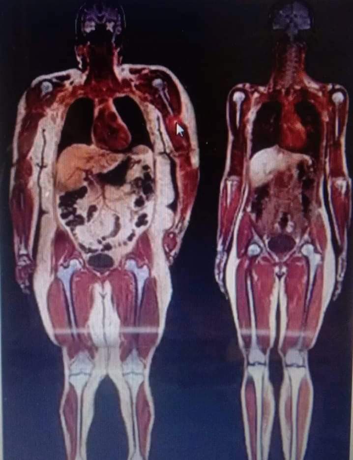 OLIVE Weight Management Center PERUMANNA